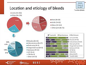 Výstupy z registru ČNHP za rok 2020 – hemofilie